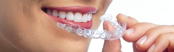 インビザラインは透明な歯列矯正装置